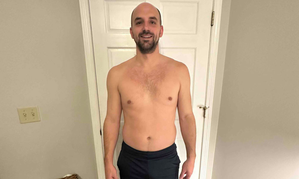 Before Transformation 3