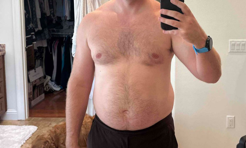 Before Transformation 6